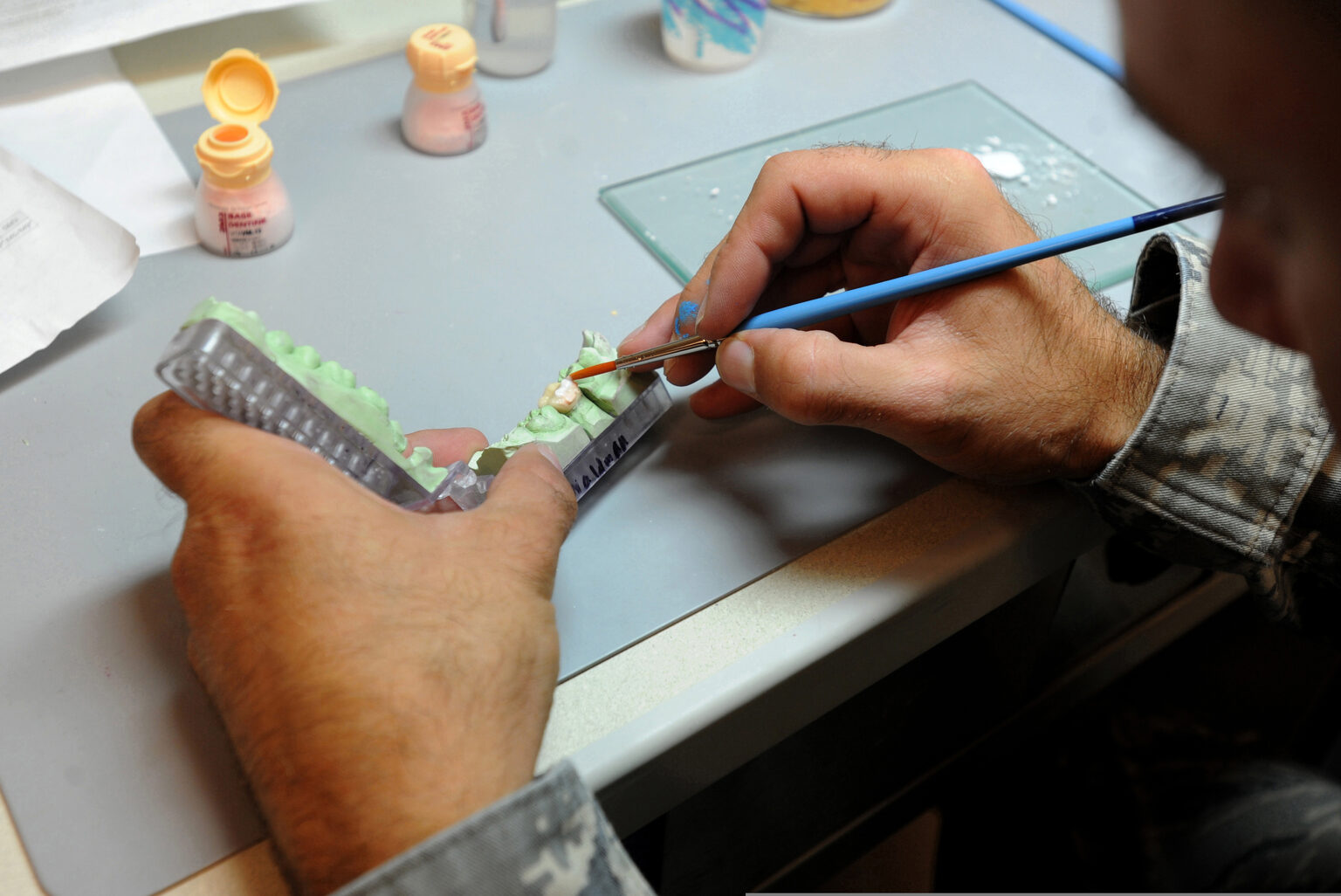 Dental lab technician brushing layers of porcelain onto a multi-tooth restoration mold