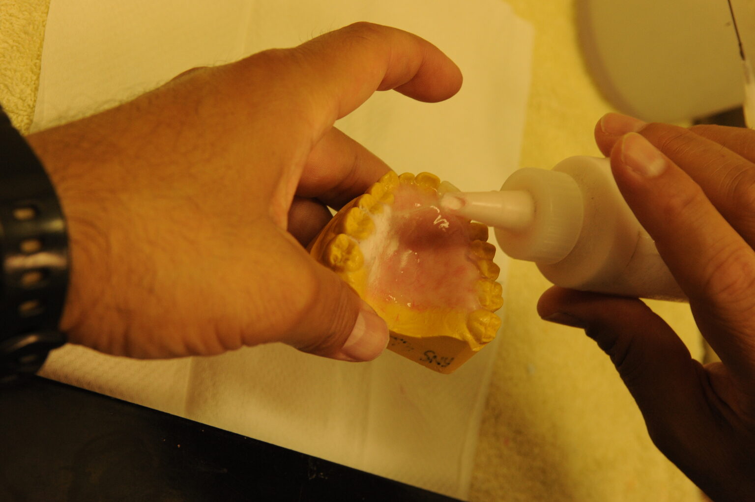 Close-up of hands applying liquid acrylic to a partial denture model on a dental lab bench